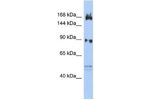Human OVCAR3; WB Suggested Anti-AFF2 Antibody Titration: 0.