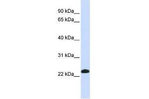 Western Blot showing CAV2 antibody used at a concentration of 1-2 ug/ml to detect its target protein. (Caveolin 2 antibody  (N-Term))