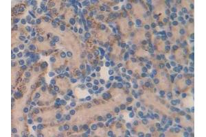 DAB staining on IHC-P; Samples: Rat Kidney Tissue (MMP23A antibody  (AA 71-383))