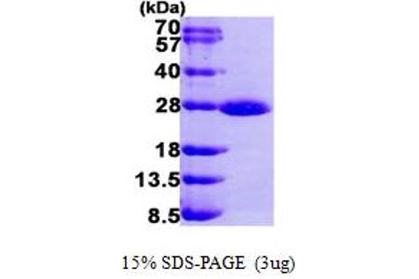 RAB1A Protein (AA 1-205) (His tag)