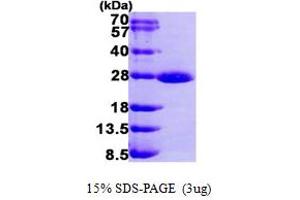 SDS-PAGE (SDS) image for RAB1A, Member RAS Oncogene Family (RAB1A) (AA 1-205) protein (His tag) (ABIN7529163)