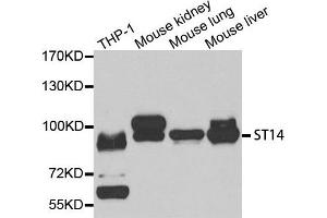 Western Blotting (WB) image for anti-Suppression of Tumorigenicity 14 (Colon Carcinoma) (ST14) antibody (ABIN1877121) (ST14 antibody)