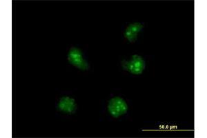 Immunofluorescence of purified MaxPab antibody to SNIP1 on HeLa cell. (SNIP1 antibody  (AA 1-396))