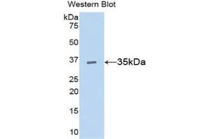 Detection of Recombinant CCND1, Rat using Polyclonal Antibody to Cyclin D1 (CCND1) (Cyclin D1 antibody  (AA 1-295))