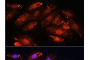 Immunofluorescence analysis of H9C2 cells using OTUB1 Polyclonal Antibody at dilution of 1:100. (OTUB1 antibody)