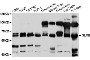 Western blot analysis of extracts of various cell lines, using GLRB antibody (ABIN4903772) at 1:1000 dilution. (GLRB antibody)