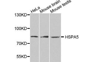 Western blot analysis of extracts of various cell lines, using HSPA5 antibody. (GRP78 antibody  (AA 550-650))