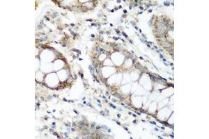 Immunohistochemistry of paraffin-embedded human colon using N antibody (ABIN6133455, ABIN6144330, ABIN6144331 and ABIN6223249) at dilution of 1:200 (40x lens).