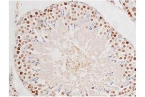 Immunohistochemistry (IHC) image for anti-Microtubule-Associated Protein tau (MAPT) (pSer235) antibody (ABIN6256205)