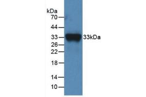 Detection of Recombinant F11, Mouse using Polyclonal Antibody to Coagulation Factor XI (F11) (Factor XI antibody  (AA 157-389))