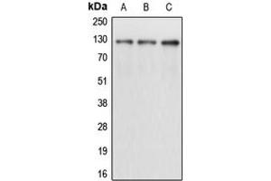 Western blot analysis of CD167a expression in A431 (A), K562 (B), T47D (C) whole cell lysates.
