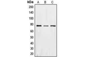 Western blot analysis of PKR expression in HeLa (A), MCF7 (B), Caco2 (C) whole cell lysates. (EIF2AK2 antibody  (C-Term))