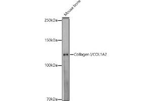 Western blot analysis of extracts of Mouse bone, using Collagen I/COL1 antibody (1059) at 1:1000 dilution. (COL1A2 antibody)