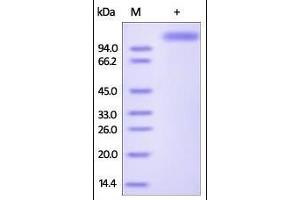 Influenza A [A/Shanghai/2/2013(H7N9)] HA, Fc Tag on SDS-PAGE under reducing (R) condition. (Hemagglutinin Protein (HA) (AA 19-338, AA 341-523) (Fc Tag))