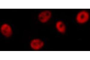 ABIN6266463 staining Hela by IF/ICC. (Retinoic Acid Receptor alpha antibody  (pSer77))