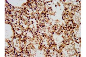 IHC image of ABIN7175834 diluted at 1:500 and staining in paraffin-embedded human lung tissue performed on a Leica BondTM system. (WASF2 antibody  (AA 243-317))