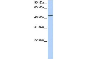 WB Suggested Anti-ICA1 Antibody Titration: 0. (ICA1 antibody  (C-Term))
