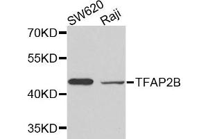 Western blot analysis of extracts of SW620 and Raji cells, using TFAP2B antibody.