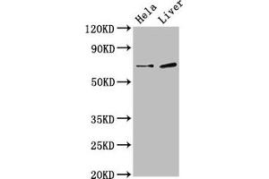 Western Blot Positive WB detected in: Hela whole cell lysate, Rat liver tissue All lanes: SSX2IP antibody at 3 μg/mL Secondary Goat polyclonal to rabbit IgG at 1/50000 dilution Predicted band size: 72, 66, 69 kDa Observed band size: 72 kDa (SSX2IP antibody  (AA 485-614))