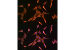 Immunofluorescence analysis of NIH-3T3 cells using RHOA/RHOB/RHOC Rabbit mAb (ABIN1678636, ABIN3019244, ABIN3019245 and ABIN7101735) at dilution of 1:100 (40x lens). (RhoA,B,C antibody)