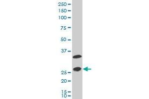 DRAP1 polyclonal antibody (A01), Lot # 051019JCO1 Western Blot analysis of DRAP1 expression in A-431 . (DRAP1 antibody  (AA 2-105))