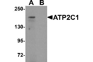 Western blot analysis of ATP2C1 in mouse brain tissue lysate with ATP2C1 antibody at 1 µg/mL in (A) the absence and (B) the presence of blocking peptide.
