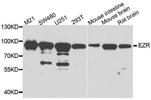 Western blot analysis of extracts of various cell lines, using EZR antibody. (Ezrin antibody  (AA 350-470))