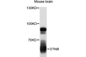 Western blot analysis of extracts of mouse brain, using DTNB antibody (ABIN6294202) at 1:3000 dilution.