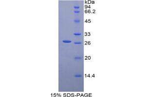 SDS-PAGE analysis of Mouse Glucuronidase beta Protein.