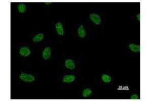 Immunostaining analysis in HeLa cells. (NUDT21 antibody)