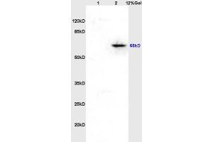 Lane 1: rat brain lysates Lane 2: rat heart lysates probed with Anti hospho-Paxillin (Tyr118) Polyclonal Antibody, Unconjugated (ABIN745043) at 1:200 in 4 °C. (Paxillin antibody  (pTyr118))