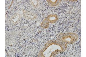 Immunoperoxidase of monoclonal antibody to FLJ20643 on formalin-fixed paraffin-embedded human endometrium. (PIH1D1 antibody  (AA 1-290))