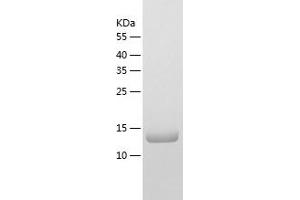 Western Blotting (WB) image for Kisspeptin (KISS1) (AA 20-138) protein (His tag) (ABIN7287304) (KISS1 Protein (AA 20-138) (His tag))