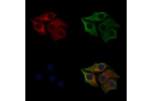 ABIN6255334 and ABIN6267311 staining HepG2 cells(30 min of 4uM Forskolin treatment) by IF/ICC. (KRT8 antibody  (pSer432))
