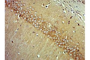 Paraformaldehyde-fixed, paraffin embedded mouse brain, Antigen retrieval by boiling in sodium citrate buffer (pH6) for 15min, Block endogenous peroxidase by 3% hydrogen peroxide for 30 minutes, Blocking buffer (normal goat serum) at 37°C for 20min, Antibody incubation with MAP3K13 Polyclonal Antibody  at 1:400 overnight at 4°C, followed by a conjugated secondary and DAB staining. (MAP3K13 antibody  (AA 801-900))