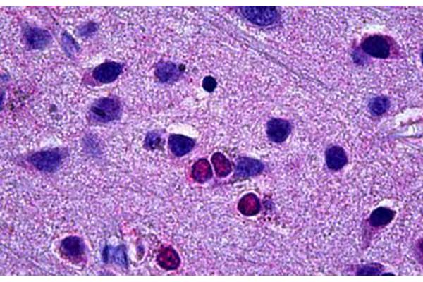 EBF3 antibody