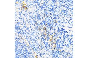 Immunohistochemistry of paraffin-embedded mouse spleen using CAMP antibody (ABIN3022305, ABIN3022306, ABIN3022307, ABIN1512664 and ABIN6218724) at dilution of 1:200 (40x lens). (Cathelicidin antibody  (AA 31-170))