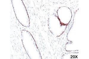 IHC staining of human prostate (20X) with HMW Cytokeratin antibody (34bE12). (KRT1 antibody)