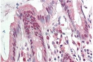 Rabbit Anti-RAD23B antibody Catalog Number: ARP56505 Formalin Fixed Paraffin Embedded Tissue: Human Adult Colon  Observed Staining: Cytoplasm in hepatocytes Primary Antibody Concentration: 1:600 Secondary Antibody: Donkey anti-Rabbit-Cy3 Secondary Antibody Concentration: 1:200 Magnification: 20X Exposure Time: 0. (RAD23B antibody  (Middle Region))