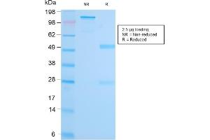 SDS-PAGE Analysis Purified MALT1 Recombinant Rabbit Monoclonal Antibody (MT1/3159R). (Recombinant MALT1 antibody  (AA 701-808))