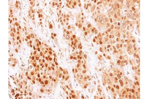 IHC-P Image Immunohistochemical analysis of paraffin-embedded BT474 xenograft, using COMMD7, antibody at 1:500 dilution. (COMMD7 antibody)