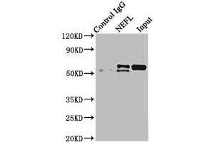 Immunoprecipitating NEFL in mouse brain tissue Lane 1: Rabbit control IgG instead of ABIN7161278 in mouse brain tissue. (NEFL antibody  (AA 128-271))