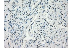 Immunohistochemical staining of paraffin-embedded endometrium tissue using anti-FCGR2A mouse monoclonal antibody. (FCGR2A antibody)