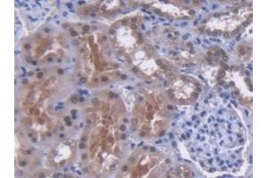 DAB staining on IHC-P; Samples: Human Kidney Tissue (MUTYH antibody  (AA 351-544))