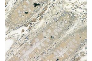 ABIN6261221 and ABIN6278110 at 1/100 staining human normal colon tissue by IHC-P. (DAP Kinase 1 antibody  (Internal Region))