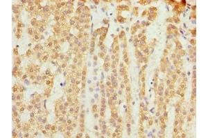 Immunohistochemistry of paraffin-embedded human adrenal gland tissue using ABIN7159878 at dilution of 1:100 (SLC25A18 antibody  (AA 246-287))