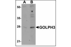 Western blot analysis of GOLPH3 in rat lung tissue lysate with GOLPH3 antibody at (A) 0. (GOLPH3 antibody  (N-Term))