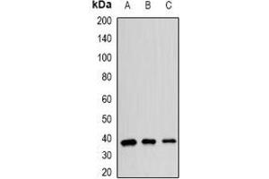 Western blot analysis of hnRNP E2 expression in SW620 (A), MCF7 (B), mouse spleen (C) whole cell lysates. (PCBP2 antibody)