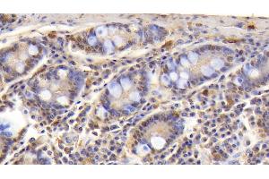 Detection of CD3e in Human Small intestine Tissue using Polyclonal Antibody to T-Cell Surface Glycoprotein CD3 Epsilon (CD3e) (CD3 epsilon antibody  (AA 28-185))