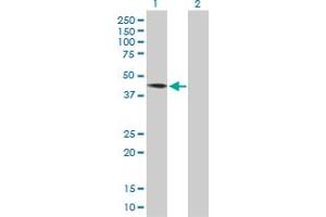 Western Blot analysis of DYX1C1 expression in transfected 293T cell line by DYX1C1 MaxPab polyclonal antibody. (DYX1C1 antibody  (AA 1-381))